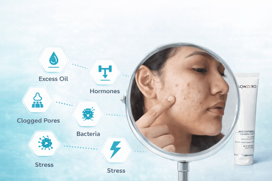 5 Common Causes of Acne and How to Treat Them Effectively