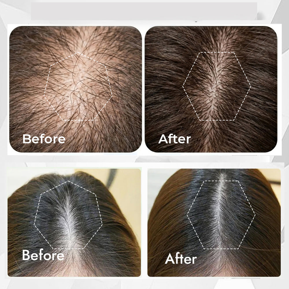 Before and after comparison of hair treatment on different scalp areas.